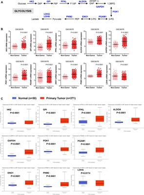 High Expression of Glycolytic Genes in Cirrhosis Correlates With the Risk of Developing Liver Cancer